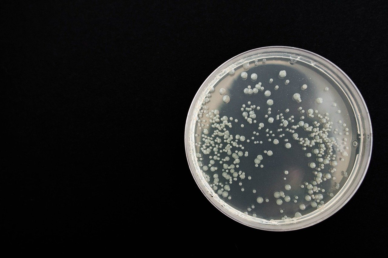 Image of Petri dish with bacteria